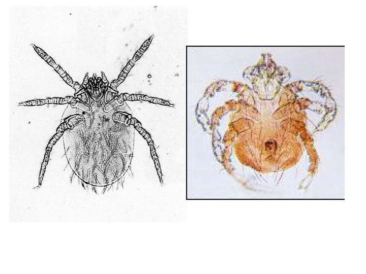 ツツガムシ病を媒介するLeptotrombidium属のツツガムシ